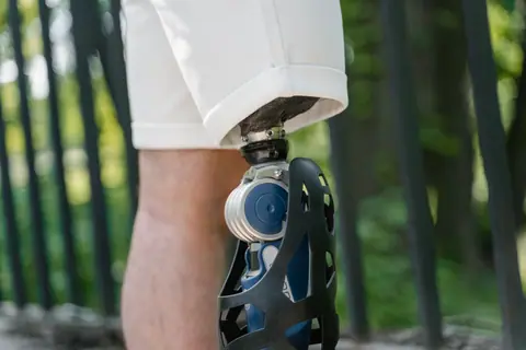 Detailed view of a modern prosthetic leg showcasing advanced technology.