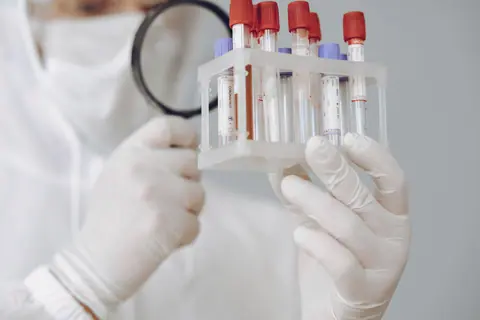 A laboratory scientist examines blood samples using protective gear and a magnifying glass.