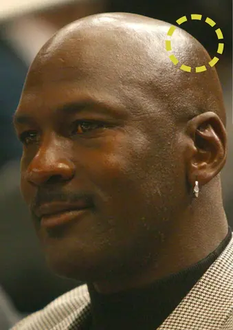 Michael Jordan - Parietal eminence