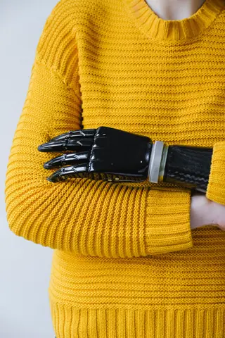 Close-up of a prosthetic arm crossed over a yellow knitted sweater, highlighting modern assistive technology.